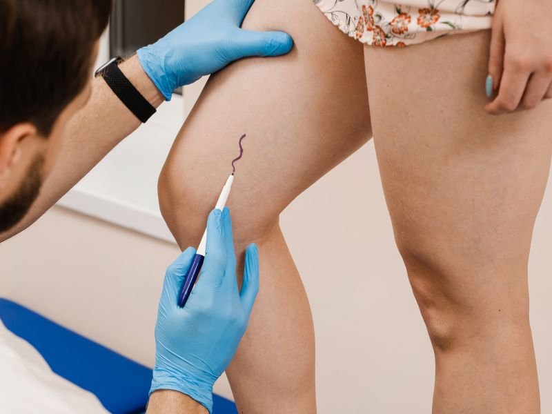 Beneficios e Limitacoes do CLaCS em Belo Horizonte