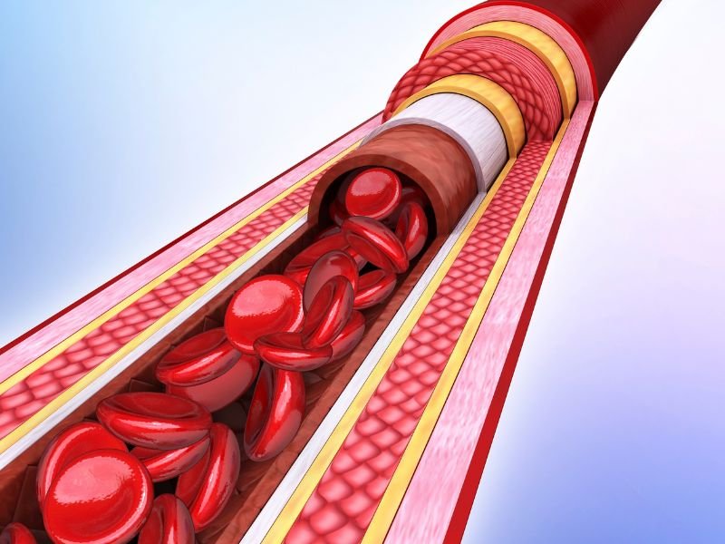 Colesterol Alto Como Proteger Suas Arterias e Evitar Riscos a Saude Vascular em Belo Horizonte