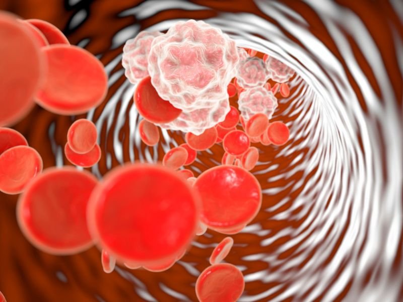 Fortaleca seus Vasos Sanguineos e Evite Problemas Circulatorios em Belo Horizonte